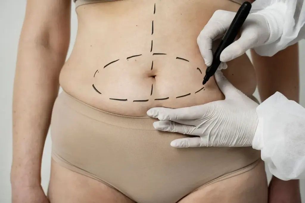 A Woman Receiving the Body Contouring Treatment at Brandish Clinic Facial and Skin Rejuvenation in La Jolla, California