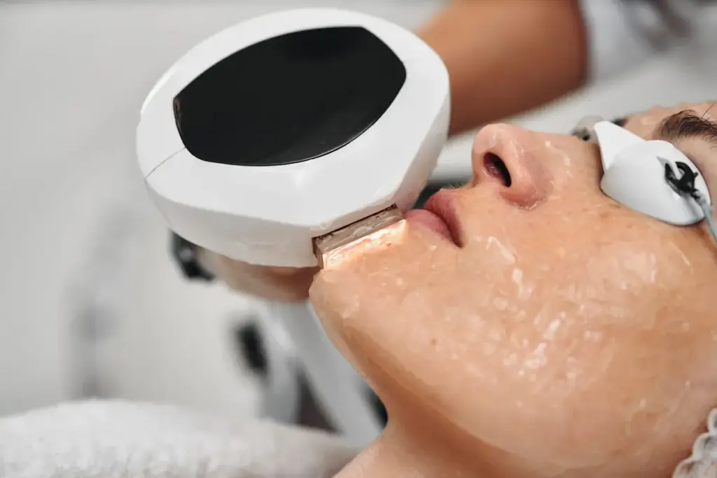 A woman receives a IPL Pulling all Sun Damage Treatment at Brandish Clinic Facial and Skin Rejuvenation in La Jolla, California.