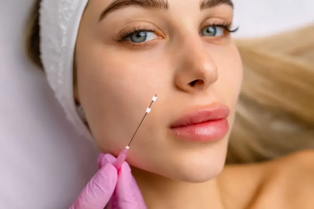 A Woman Receiving the PDO Threads Treatment at Brandish Clinic Facial and Skin Rejuvenation in La Jolla, California